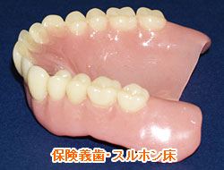 スルホン床義歯（保険適用）